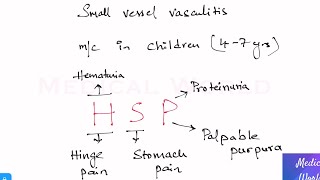 IgA Vasculitis  Henoch Schonlein Purpura Mnemonic [upl. by Binah]