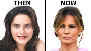 Melania Trumps NEW FACE  Plastic Surgery Analysis [upl. by Esdras]