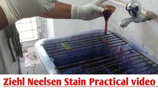 Ziehl Neelsen Stain ZN Stain  Acid Fast Staining  ZN Stain Microbiology Practical Class [upl. by Nirrat]