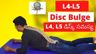 Yoga For Lower Back PainSlip Discமுதுகு வலியை போக்கும் யோகா in Tamil by DrLakshmi Andiappan [upl. by Siskind331]