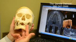 CAT Scan use in a Shelby Township Dental Office [upl. by Yknarf]