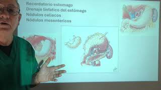 Cáncer de Estómago Oxidative Stress Mitosis y Meiosis Proceso anarquicoproliferativo [upl. by Benil908]