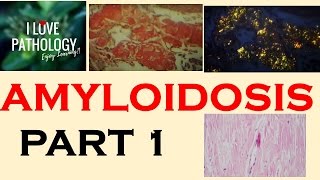 AMYLOIDOSIS Part 1 Definition Historical aspects amp Properties of Amyloid [upl. by Lebazi24]