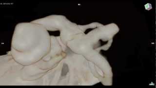 Cochlea  Inner Ear 3D MRI：内耳、蝸牛、三半規管 [upl. by Eram868]