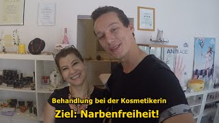 AKNEBehandlung bei der KOSMETIKERIN LIVE [upl. by Ennaylil869]