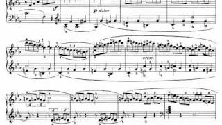 Beethoven Sonata quotPathetiquequot Op 13  III Rondo Allegro [upl. by Aremihc]