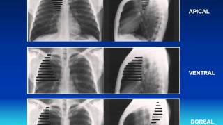 RADIOLOGIE ANATOMIE LOBAIRE ET SEGMENTAIRE [upl. by Ydor289]