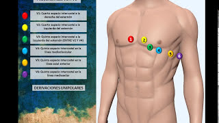 Electrocardiograma 01 Colocación Correcta de Electrodos [upl. by Abil596]