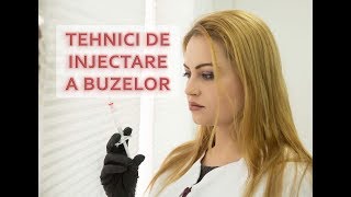 Tehnici de injectare a buzelor cu acid hialuronic [upl. by Dmitri242]