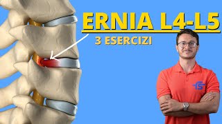 Ernia Discale L4L5  Guida completa con esercizi [upl. by Aneloc605]