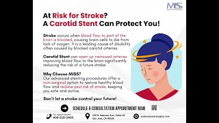 Reduce Stroke Risk with Carotid Stenting [upl. by Neumeyer]