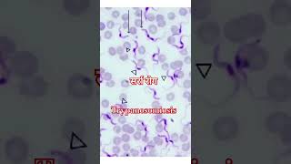 Trypanosoma [upl. by Cain]