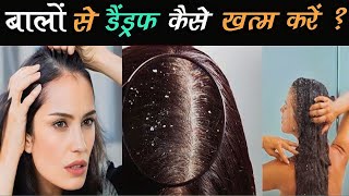 डैंड्रफ बालों का झड़ना कैसे रोके  🤯 Hair Loss Dandruff Problem [upl. by Weinert]