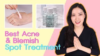 BEST must watch Acne Treatment Solutions for Ance Prone Skin [upl. by Drape127]