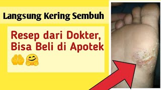 Gatel Telapak Kaki Jadinya Sampe Parah Gini Di Obatin Pake Resep Dokter Beli Di Apotek Murah [upl. by Rayford]