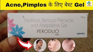 Peroduo Gel Use in Hindi  Benzoyl peroxide amp Adapalene Gel Use  Acne  pimples  SK MEDICINE [upl. by Palgrave]