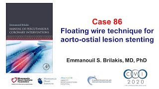 Case 86 PCI Manual  Floating wire technique for aortoostial lesion [upl. by Friedland]