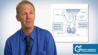 Vasectomy What is it And how does it work  Prof Rob McLachlan [upl. by Nalyk]