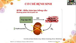 SHKH Cập nhật KDIGO 2024 đến thực hành lâm sàng Điều trị thiếu máu trên bệnh nhân bệnh thận mạn [upl. by Htevi]