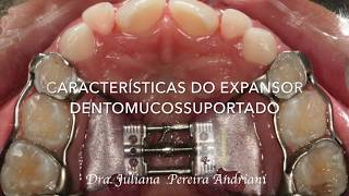 Características do expansor dentomucossuportado tipo Haas [upl. by Attey]