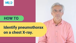 How to identify pneumothorax on a chest Xray [upl. by Nauqaj]