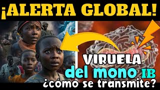 ALERTA ⚠️ VIRUELA DEL MONO LA NUEVA AMENAZA GLOBAL ¿CÓMO SE TRANSMITE [upl. by Nyleda]