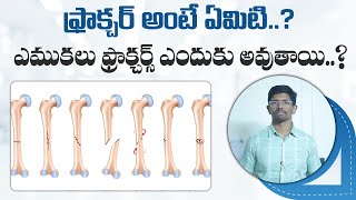 fractureseries  Basics of Fractures  Fracture  Bone Fracture  Dr Vamshis Orthopaedic Center [upl. by Anwahsar629]