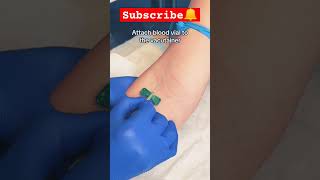 Learn How to Collect blood Sample like pro bloodcollection [upl. by Mendez463]