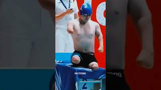 How Hand Transplant Works 😱 shorts [upl. by Spatz]