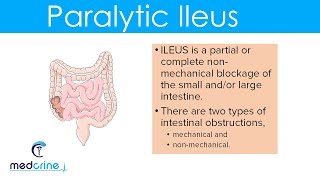 Paralytic Ileus  causes pathophysiology clinical features diagnosis and treatment [upl. by Noerb]