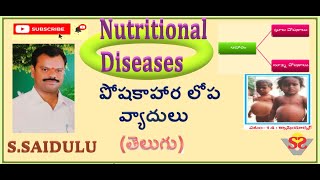 Nutritional deficiency diseases  Marasmus and Kwashiorkor  Types of nutrients  Macro nutrients [upl. by Akerdnuhs]