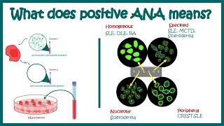 Antinuclear Antibodies ANA test and their patterns  ANA test  What does ANA test positive mean [upl. by Kennett]