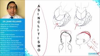 Distocias  Maniobras USAMEDIC  Obstericia 5 [upl. by Gallenz]