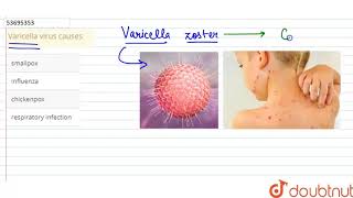 Varicella virus causes [upl. by Finkelstein]