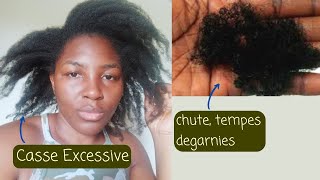 Tempes dégarnies alopécie de traction Cheveux Morts 3 Causes Surprenantes [upl. by Sinnek]