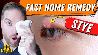 Super FAST Home Remedy For An Eyelid Stye [upl. by Haimes122]