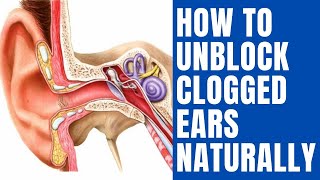 How To Unblock Clogged Ears Naturally  10 Proven Home Remedies for Clogged Ears [upl. by Penelope]