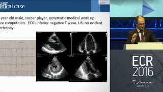 Cardiomyopathies From Diagnosis to Prognosis [upl. by Nhguavoj]