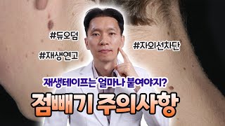 점빼기 주의사항💡 점제거후 관리방법✨ 듀오덤은 언제까지 │흉터 붉은기 │대전│ [upl. by Nonnaer]