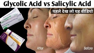 Glycolic Acid Vs Salicylic Acid  Dark spot Hyper pigmentation Skin Whitening Chemical Peeling [upl. by Annadal]