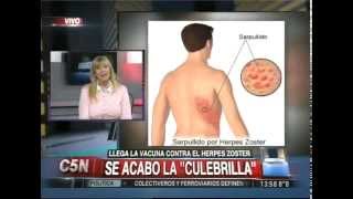 C5N  SALUD LLEGA LA VACUNA CONTRA EL HERPES ZOSTER [upl. by Caraviello]