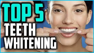 Best Teeth Whitening Strips In 2024 Professional Whitestrips Kits [upl. by Fruin]