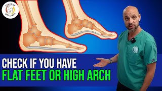 How To Check if You Have Flat Feet or High Arch [upl. by Pitchford490]