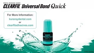 CLEARFIL Universal Bond Quick Information created by Viva Learning [upl. by Barlow]