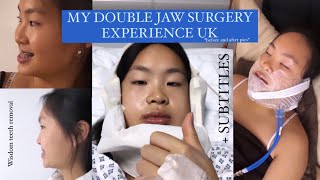 Double jaw surgery amp wisdom teeth extraction before amp after UK  WEEK 1 [upl. by Barde]