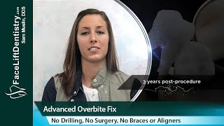 Receding Chin Misaligned Jaw Corrected in 2Weeks [upl. by Aieki621]