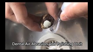 The Amazing Effect of Dental Air Abrasion and Polishing Unit [upl. by Niehaus]