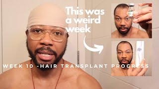 Week 10  Hair transplant progress  Things are taking a bad turn [upl. by Emerson]