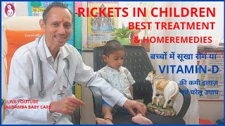 RICKETS IN CHILDREN BEST TREATMENT amp HOMEREMEDIESबच्चों में सूखा रोग VITAMIN D की कमी इलाज़ नुस्खे [upl. by Iorgo256]