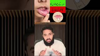 Mouth Ulcer Cause ampTreatment in Urdu amp Hindi  Moun Ke Chalon Ka Ilaj [upl. by Verdie]